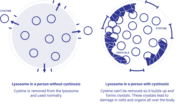 depiction of how cystine affects cells in the body